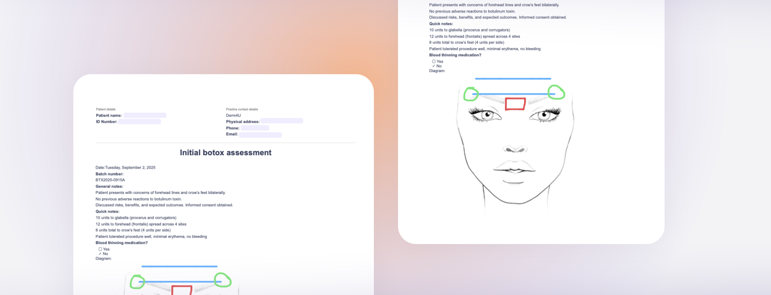 Screenshot of document containing a Botox chart
